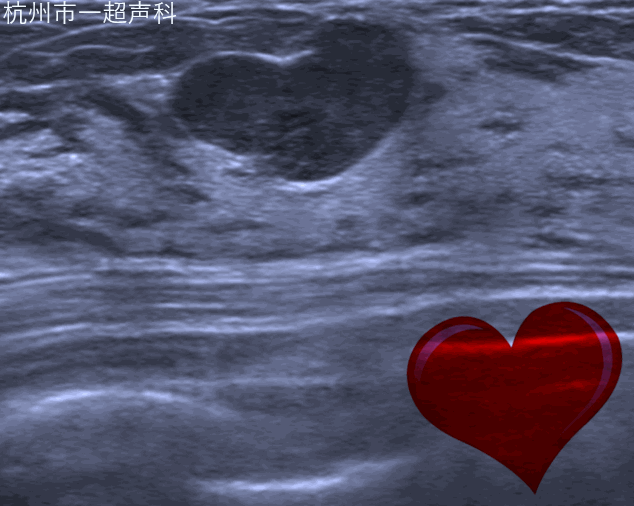 1608695004250285.gif ABVS.gif